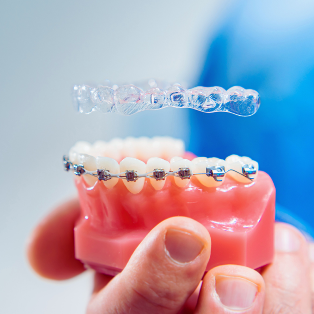 Hand holding orthodontic models displaying traditional braces and clear aligner treatment options.